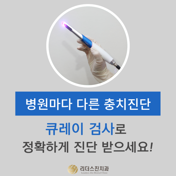 충치검사, "큐레이"로 좀 더 정확하게 진단합니다. <리더스진치과> 관련 이미지 1