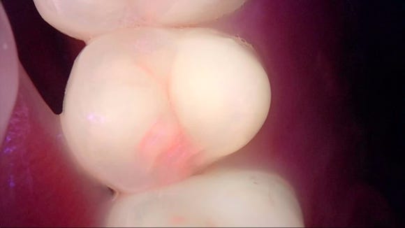 디지털 치과, 리더스진 치과의 특별한 진단 과정을 공개합니다. 관련 이미지 12