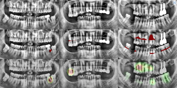 디지털 치과, 리더스진 치과의 특별한 진단 과정을 공개합니다. 관련 이미지 9