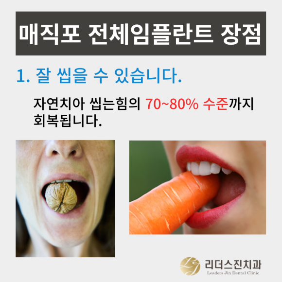 무치악환자들이 추천하는 매직포 전체임플란트 장점, <전체임플란트 중점치과 리더스진치과> 관련 이미지 2
