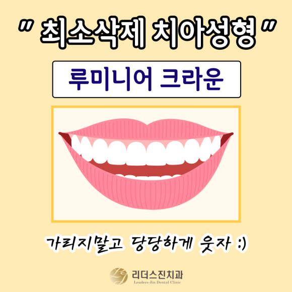 앞니 치아성형, "루미니어크라운"으로 가리지말고 당당하게 웃으세요~!!, [상도동치과 리더스진치과] 관련 이미지 1