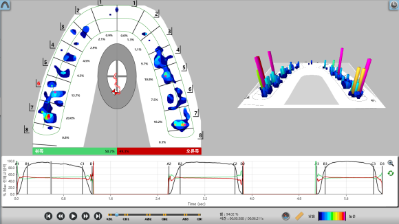 치아 교합을 정확하게 분석하는 [디지털 교합분석장비], "T-scan(티스캔)" 상도동치과, 리더스진치과 관련 이미지 5