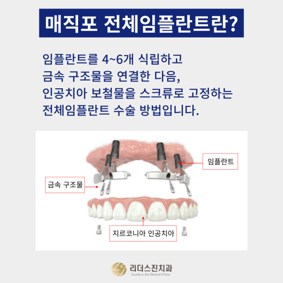 자꾸 빠지는 불편한 틀니 "매직포 전체임플란트"로 해결하세요~!! 관련 이미지 2