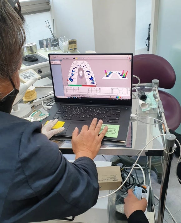 서울 상도동 치과, 99% AI 디지털 보철 원데이 보철 시스템 관련 이미지 4