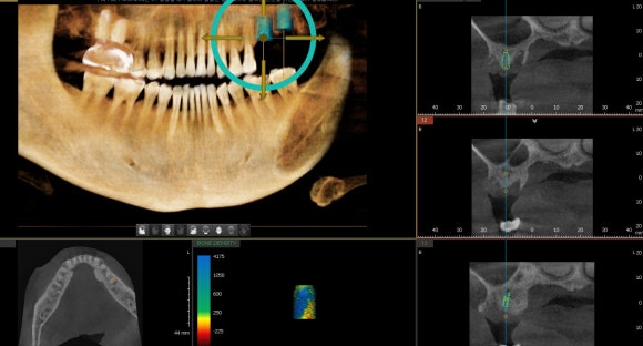 [숭실대학교입구역] 서울일 요일치과 믿을수있는치과 리더스진치과 입니다^^ 관련 이미지 1