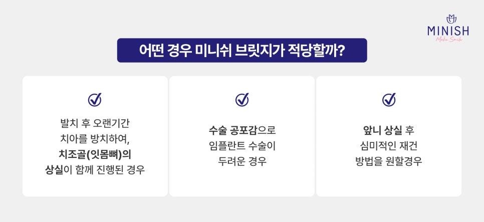 치아 브릿지 vs 미니쉬 브릿지 : 내 치아를 지키는 최적의 선택은? 관련 이미지 6