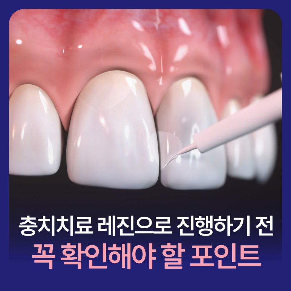 Key Points to Check Before Proceeding with Cavity Treatment Using Resin image 1