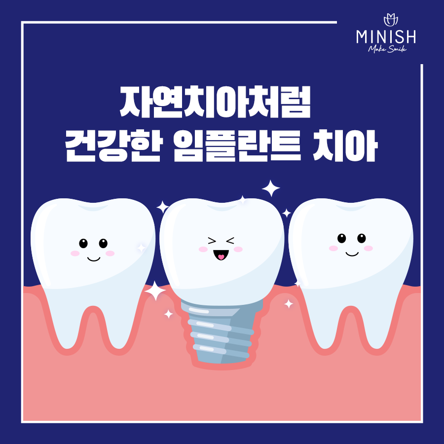 '임플란트'의 거의 모든 것 관련 이미지 14