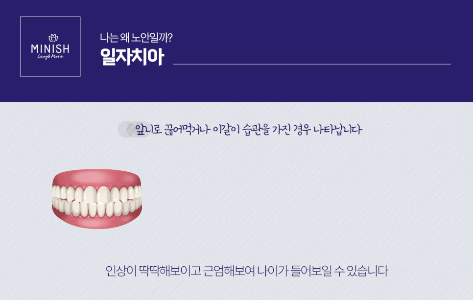 누렇고 짧은치아 개선법 관련 이미지 3
