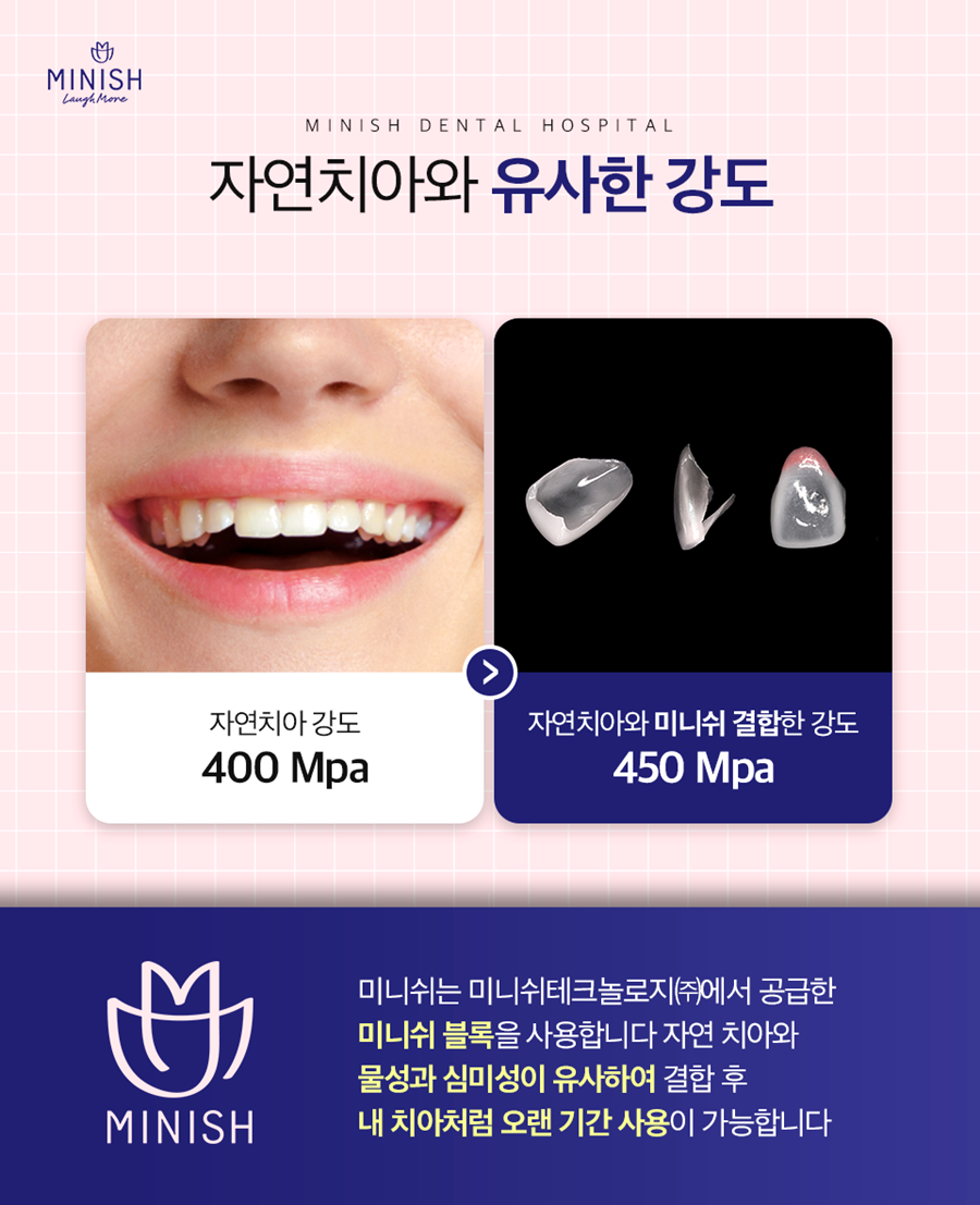 강남구청치과 건강한 아름다움, 미니쉬로 활짝 핀 자신감을 선물해 드립니다 관련 이미지 10