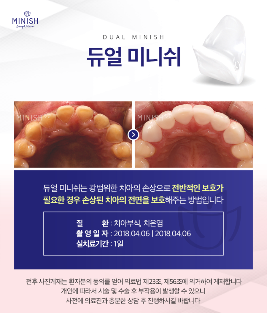 치아 건강과 아름다움을 지켜드리는 논현동치과 관련 이미지 5
