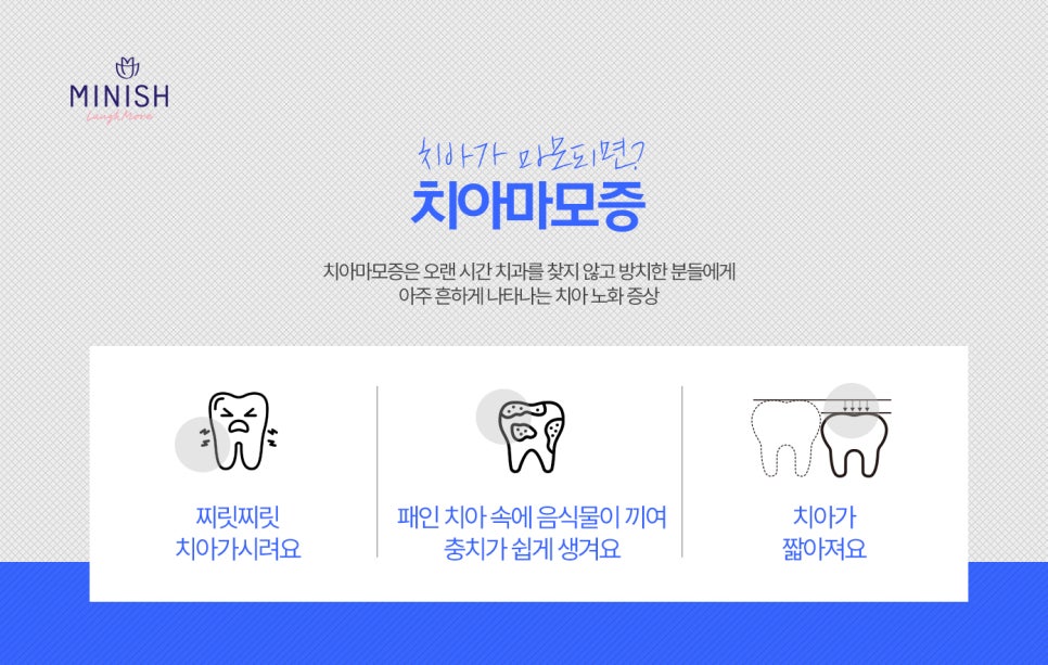 치아마모증, 치아도 나이 들까? YES! 치아 마모에는 미니쉬 관련 이미지 4