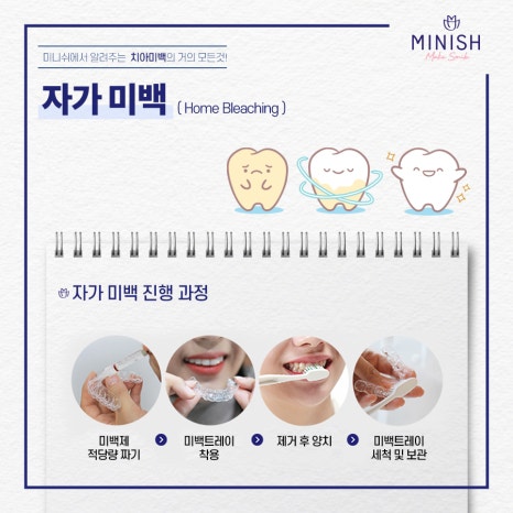 치아미백의 거의 모든 것 관련 이미지 4