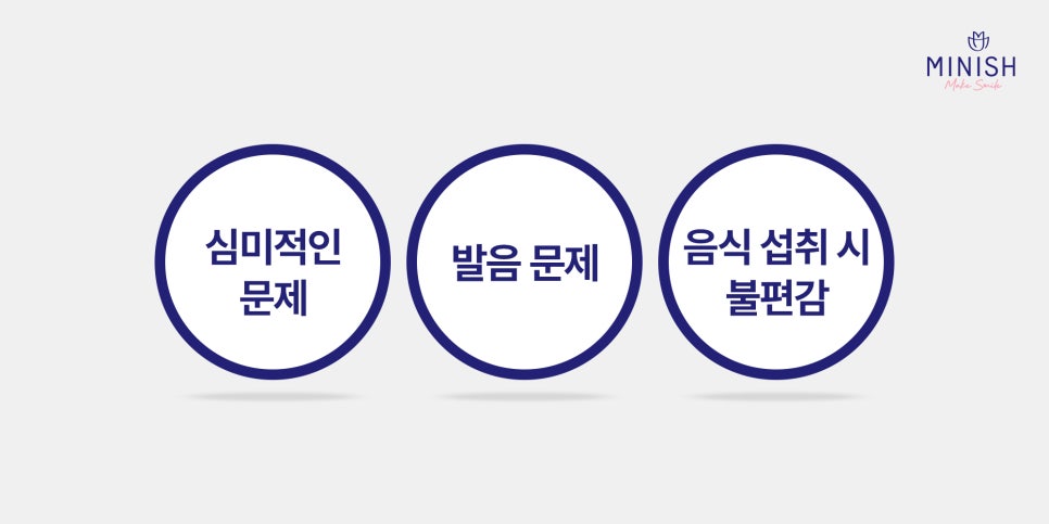 벌어진 앞니 치료 방법 세가지 장단점 관련 이미지 2