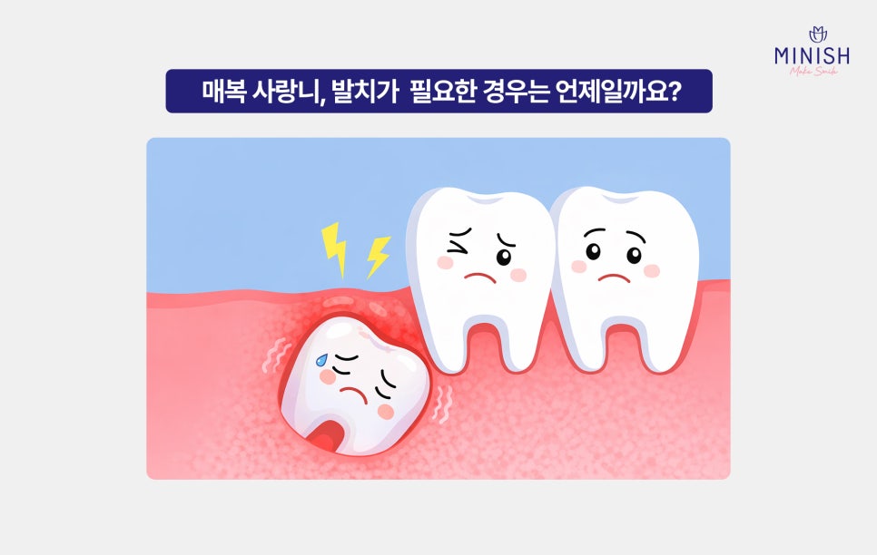 Do Wisdom Teeth Have to Be Extracted? image 5