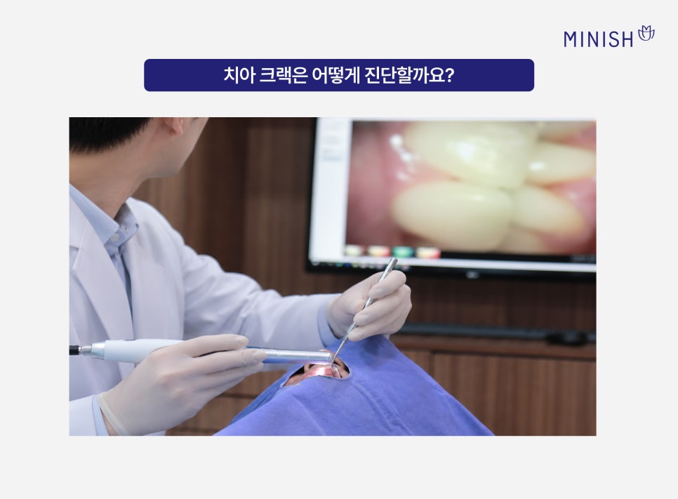 Problems That Can Occur If a Cracked Tooth Is Left Untreated and Ways to Preserve Natural Teeth image 5