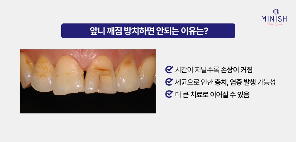 What Problems Can Occur If a Chipped Front Tooth Is Left Untreated, and How Can It Be Restored to Look Like a Natural Tooth? image 3