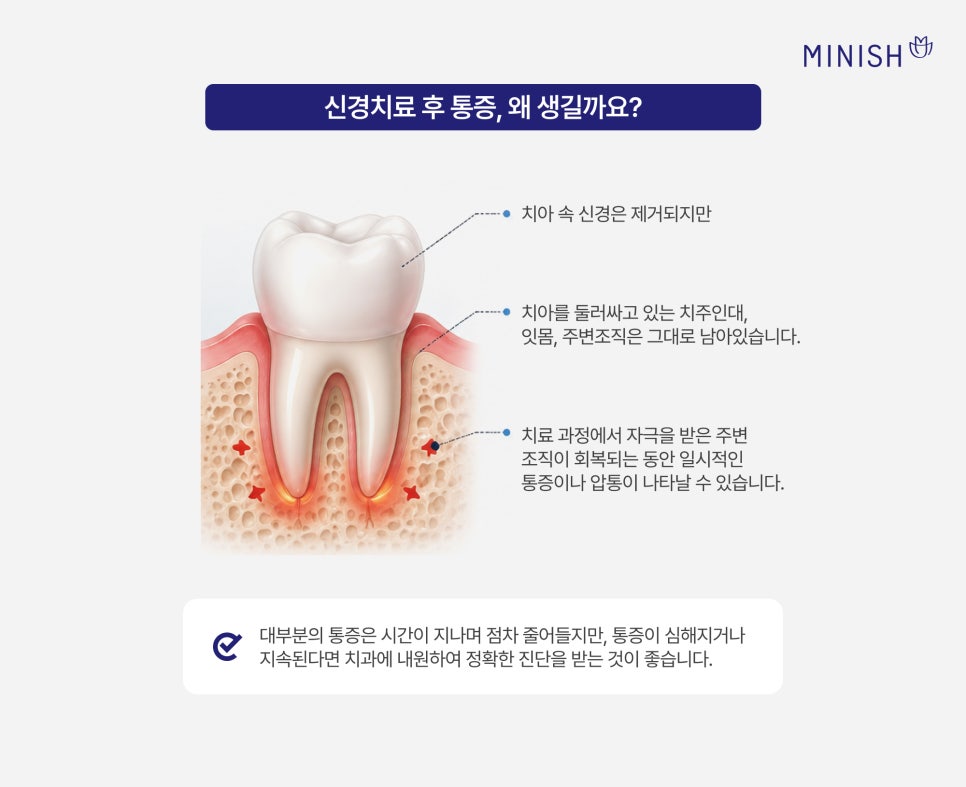 How Long Does Pain Last After Root Canal Treatment? If It Persists, Be Sure to Have It Checked! image 2
