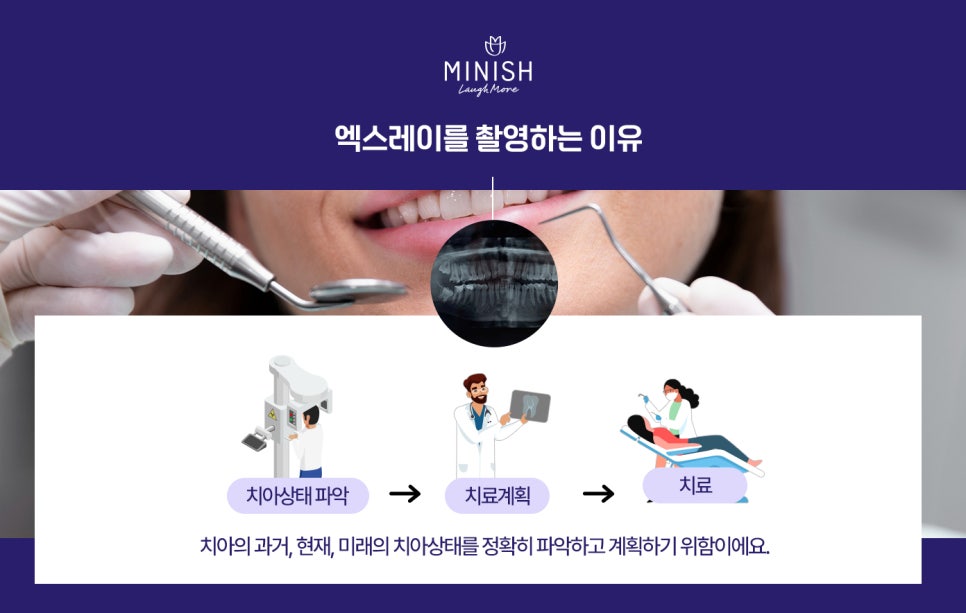 치과엑스레이는 내원할때마다 왜 촬영하는 걸까?😮 관련 이미지 6