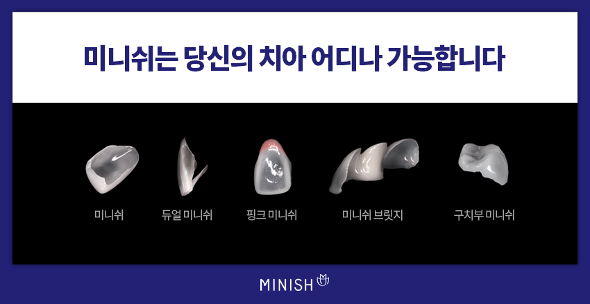 잘못된 크라운! 재치료하다 | 강남구청치과 관련 이미지 13