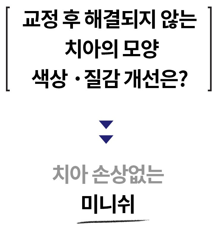 잘 보이지 않는 투명교정 하기 전에 알아두면 좋은 점 관련 이미지 6