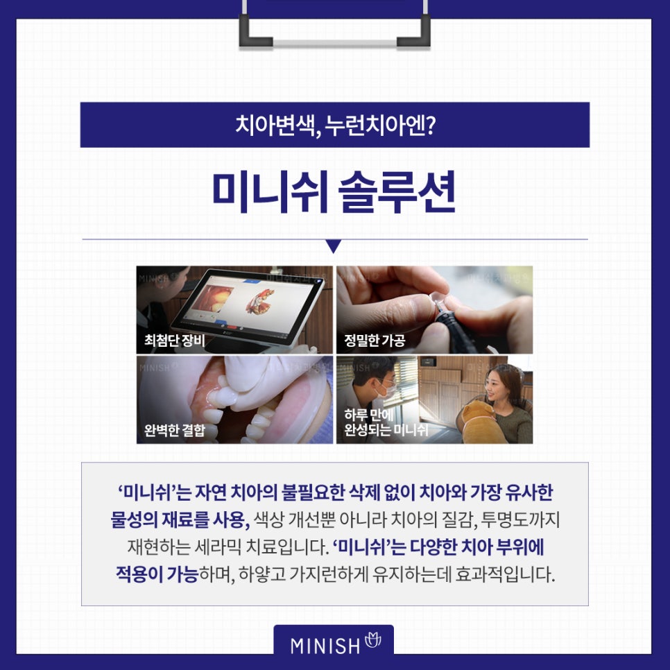 전자담배 흡연, 치아엔 어떨까? 관련 이미지 7