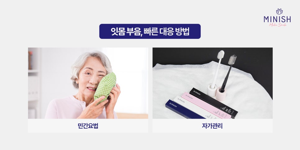 잇몸 부음, 방치하면 큰일! 원인과 치료법 알아보기 관련 이미지 5