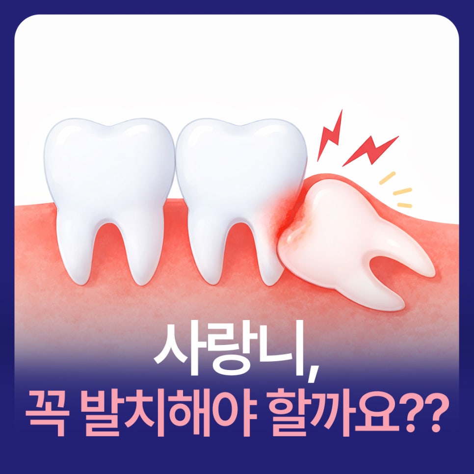 Do Wisdom Teeth Have to Be Extracted? image 1