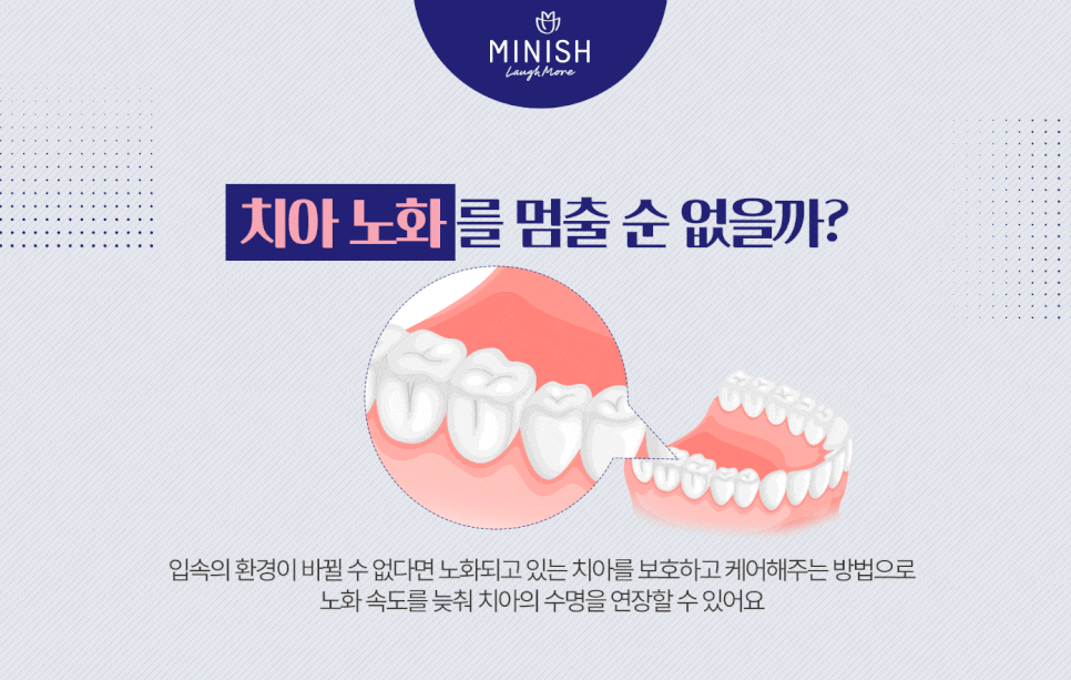 치아 수명 연장하는 법 관련 이미지 4