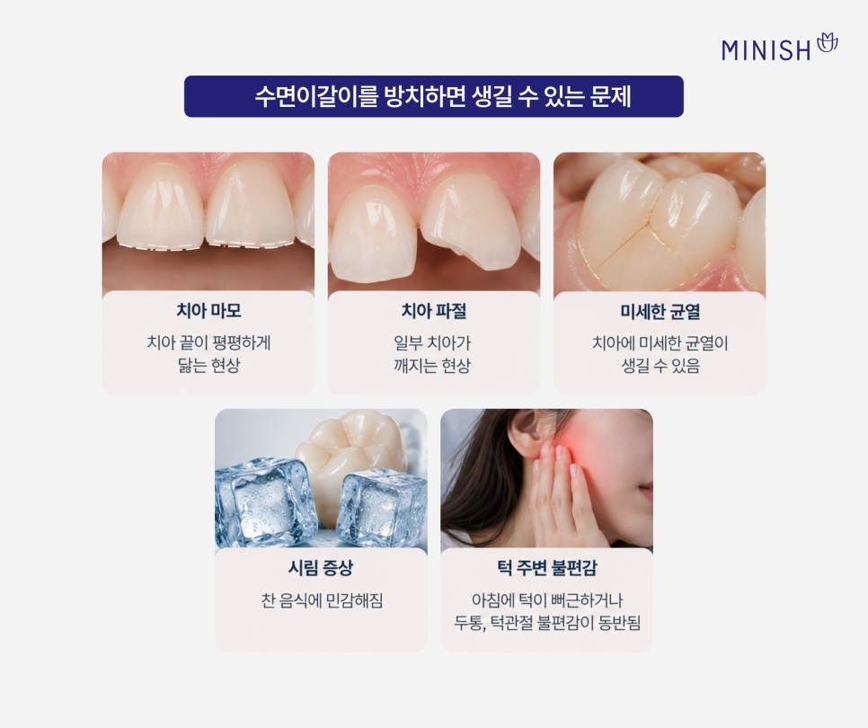 수면이갈이 원인과 증상, 이갈이 치료와 스플린트가 필요한 경우 관련 이미지 4