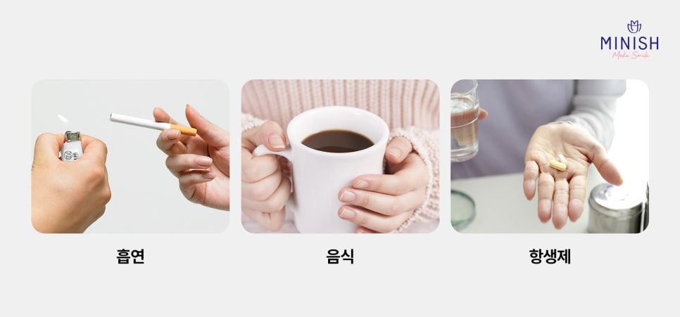 누런 치아? 치아변색 원인과 치료방법은? 관련 이미지 3