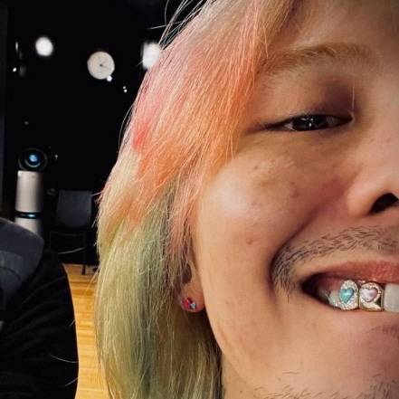 미소에도 악세사리가 필요해! 투스젬 부작용 없을까? 관련 이미지 4