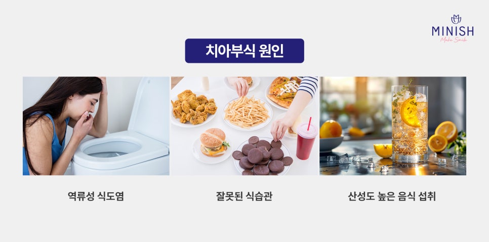 방치하면 큰일! 치아부식 증상 원인 치료 방법엔? 듀얼미니쉬 관련 이미지 2