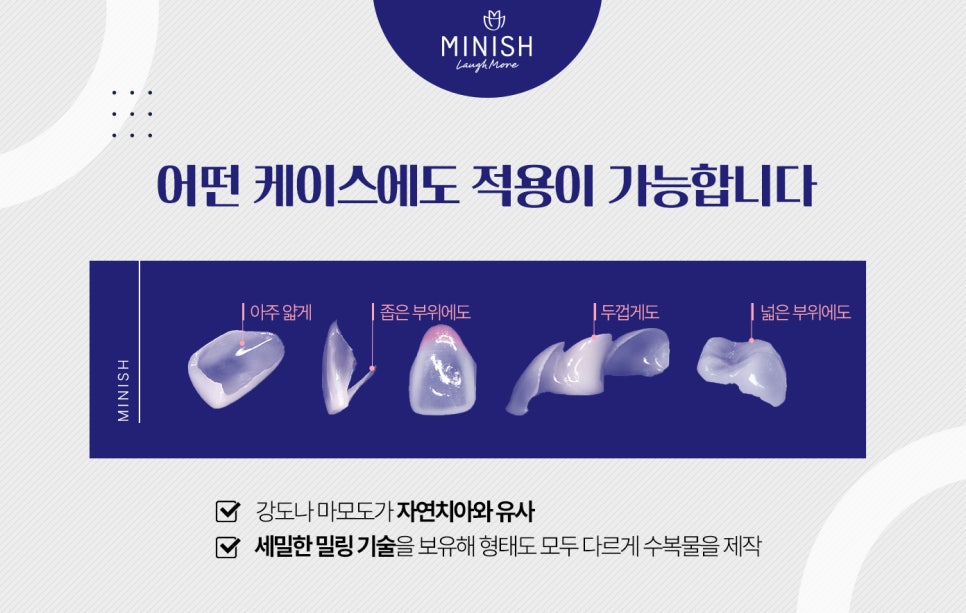 임시치아가 필요 없는 미니쉬 관련 이미지 5