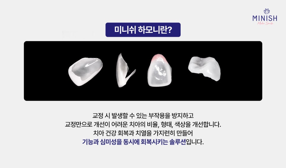 How to Restore Gapped Teeth Healthily in Just One Day image 4