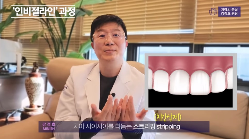 치아교정 앞둔 당신이 반드시 알아야 할 점① - 인비절라인 편 관련 이미지 4