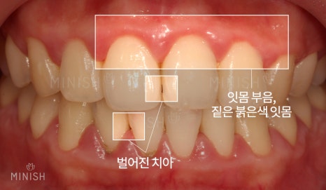 불행한 가정사를 딛고, 웃게 해준 관련 이미지 12