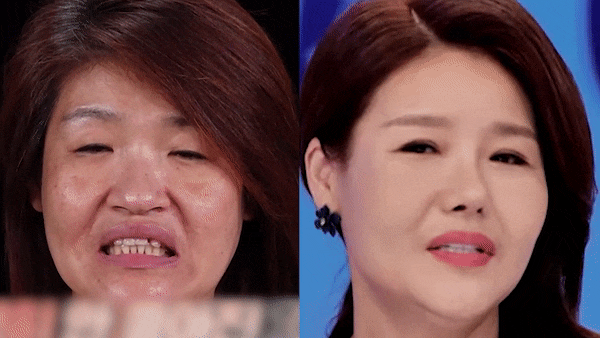 치아성형 고민? 미니쉬치과 병원에서 해결! 관련 이미지 1