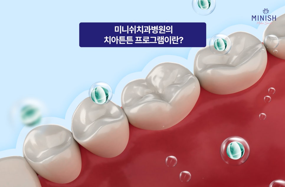 Customized Solutions for Different Dental Concerns: What Oral Care Programs Does Minish Dental Hospital Offer? image 2