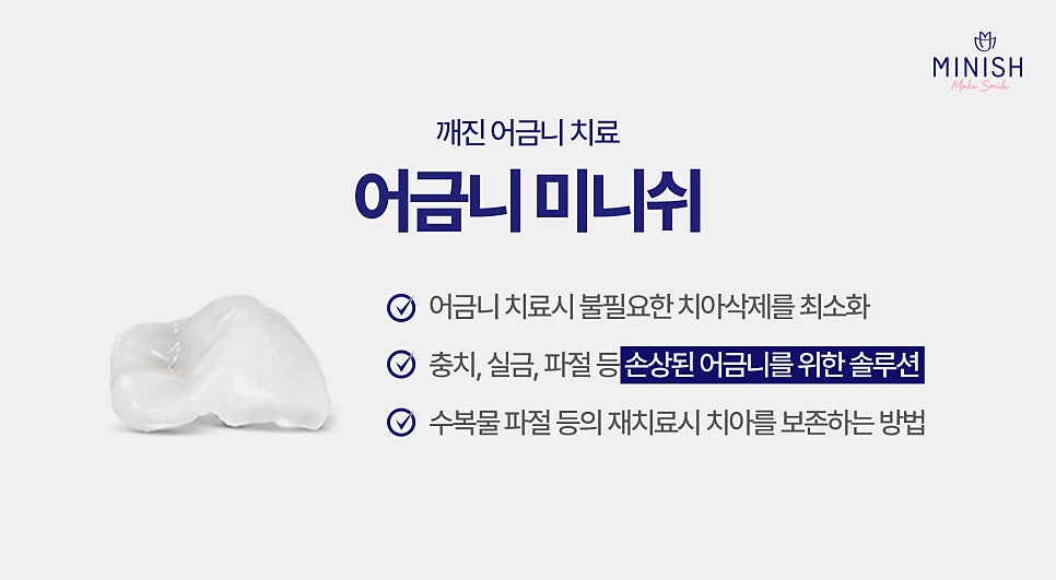 시린증상 어금니깨짐 다시 복구할 수 있는 방법 알려드려요 관련 이미지 4
