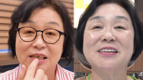 부모님 치아 노화, 변색 고민? 미니쉬 가격 고민 끝! 관련 이미지 1