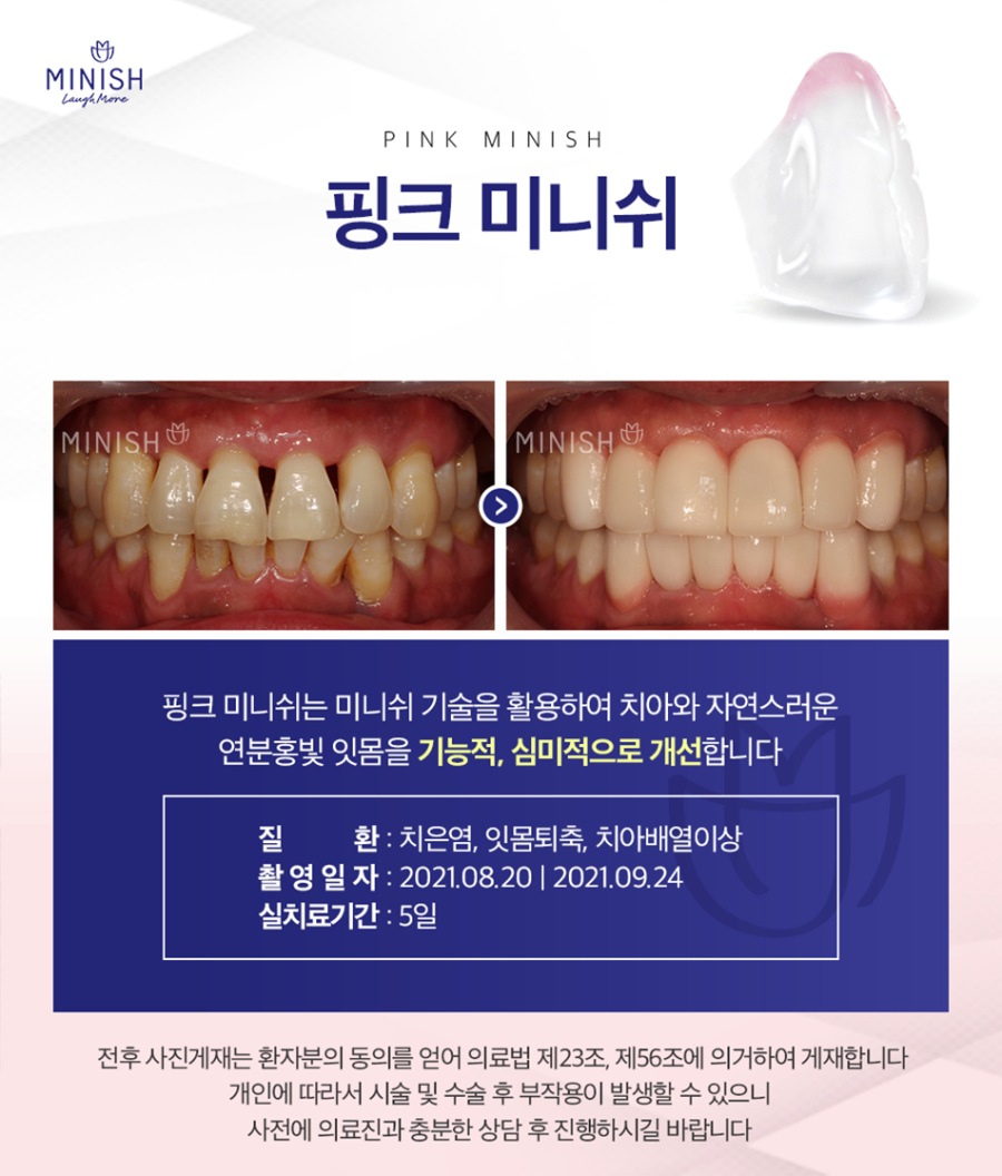 신사동치과 치아 건강과 아름다운 미소를 함께 되찾아주는 관련 이미지 5