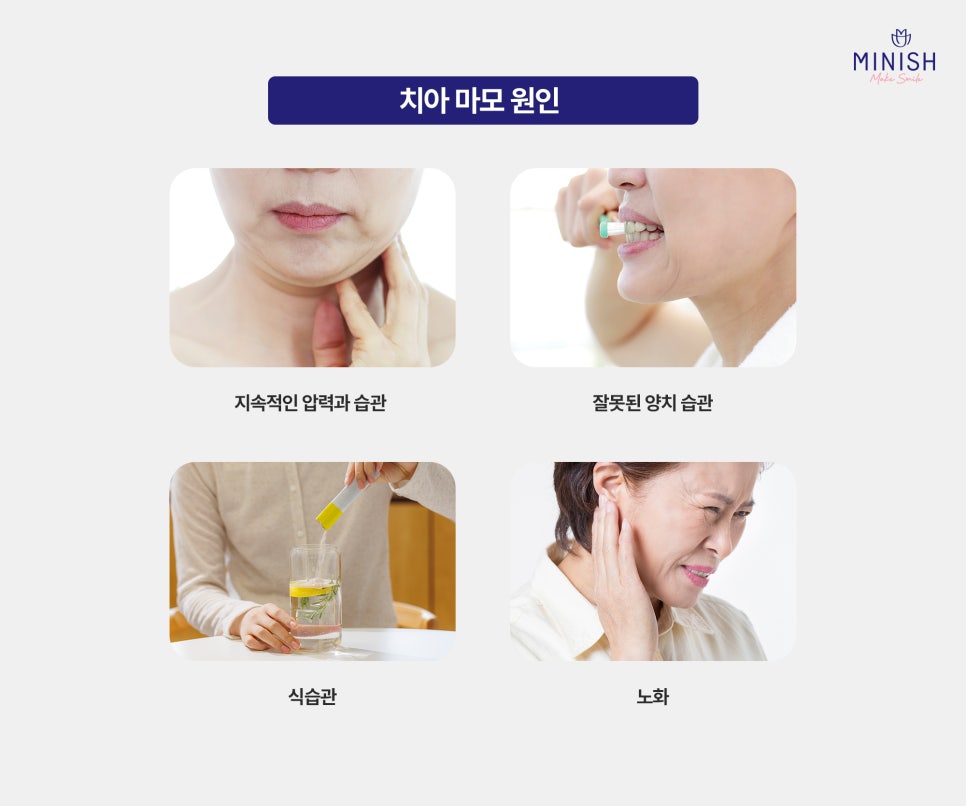 Pain Caused by Tooth Wear: From the Root Causes to Recovery Methods image 2