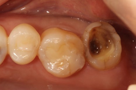A 6-Year Minish Review from a Dentist, feat. Director Lee Jeong-eun image 6
