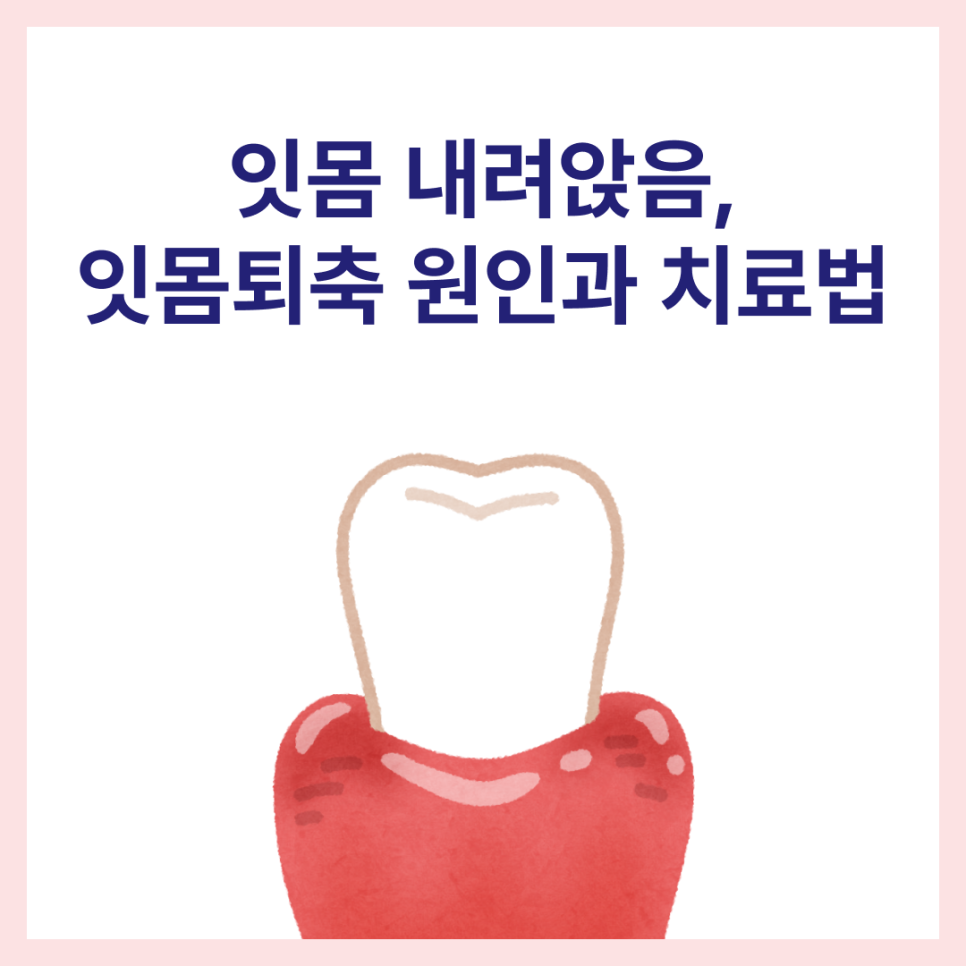 잇몸 내려앉음, 잇몸퇴축 원인과 치료 방법은? 관련 이미지 1