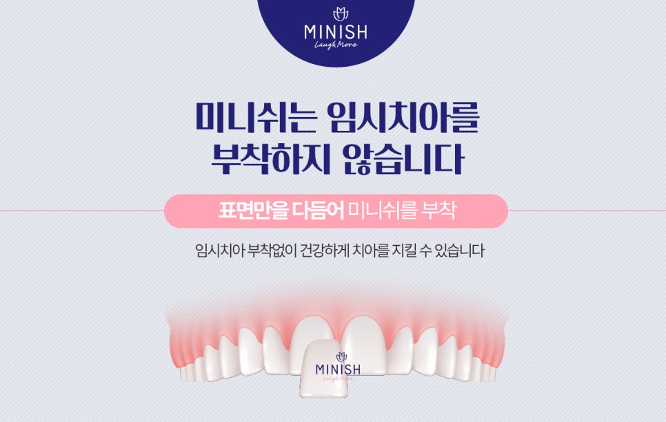임시치아가 필요 없는 미니쉬 관련 이미지 3