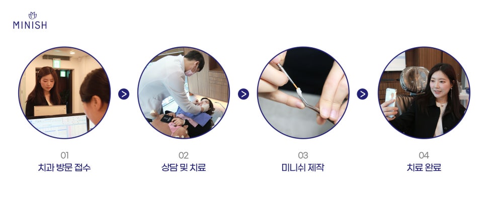 누런니 고민은 치과 치아미백 아닌 원데이미니쉬 관련 이미지 8