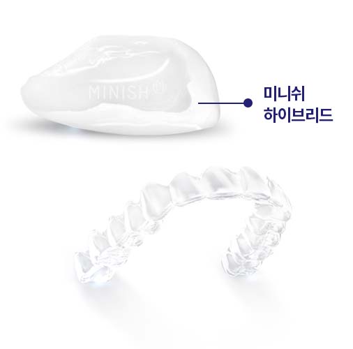 교정 후 벌어진 앞니와 블랙트라이앵글, 논현동 미니쉬치과병원에서 해결 관련 이미지 4