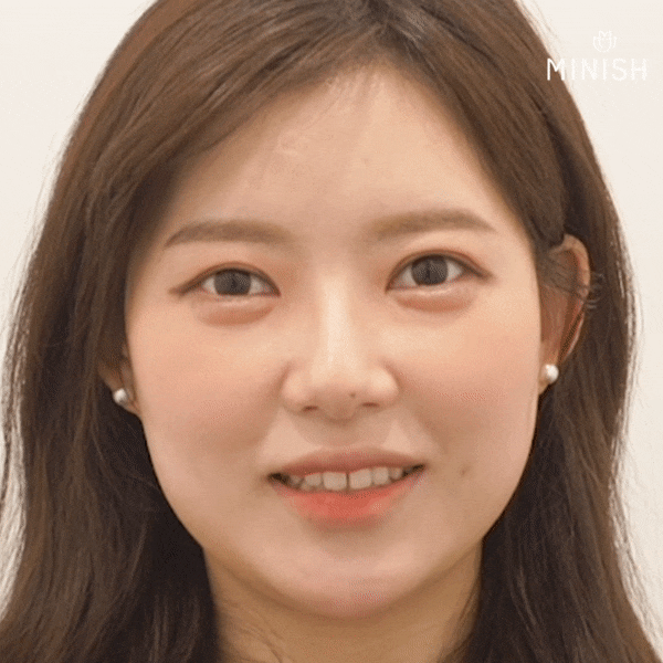 압구정 치과가 추천하는 벌어진치아 교정방법? 관련 이미지 1