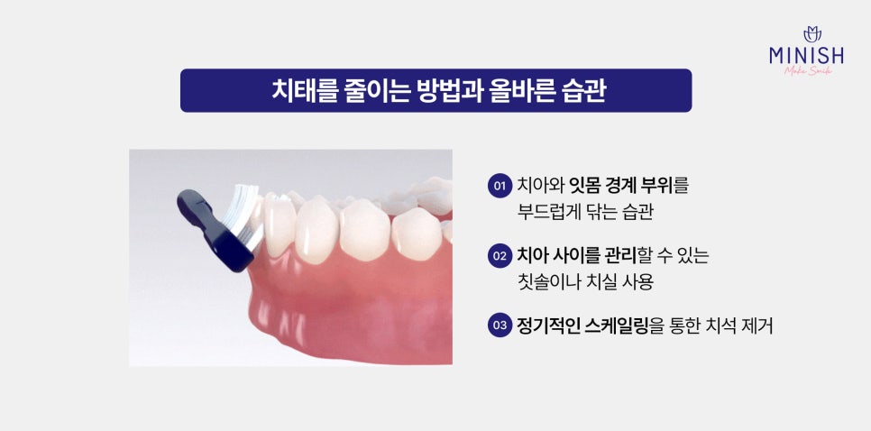 잇몸 부음 왜 생길까? 통증 반복될 때 꼭 확인해야 할 것 관련 이미지 4